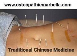 acupunctura medicina china marbella
